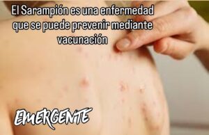 Sarampión es una enfermedad que se puede prevenir mediante vacunación