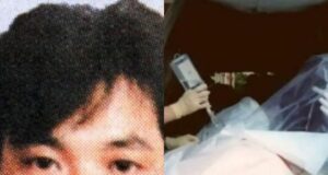 La radiación nuclear en Tokaimura en 1999